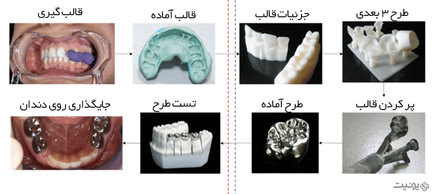پرینتر سه بعدی در دندانپزشکی