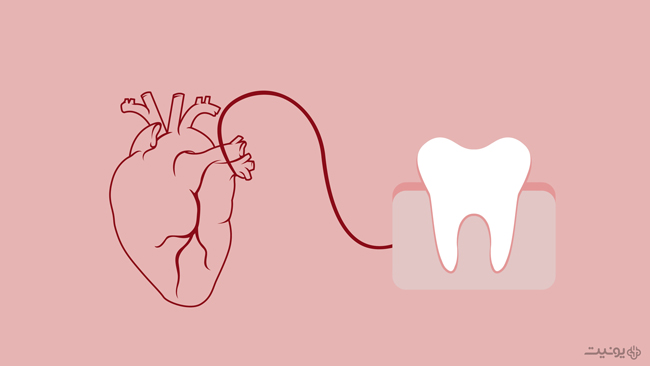 ارتباط میان بهداشت دهان و حمله قلبی
