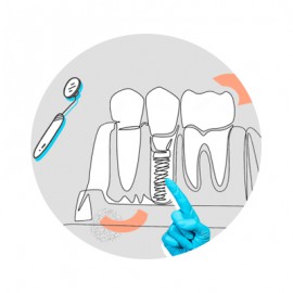 پروتز دندان چیست؟ انواع، ابزار و تجهیزات